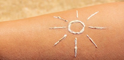 Домашна рецепта за лосион след изгаряне - Природни начини за облекчаване на кожата след слънчева изгаряне